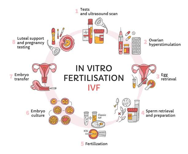 ivf